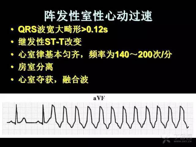 阵发性室上性心动过扑：心跳的疯狂舞步，如何应对？